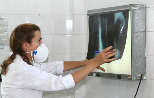  TUBERCULOSE: Dados da OMS mostram que a pandemia reverteu anos de progresso no combate à doença