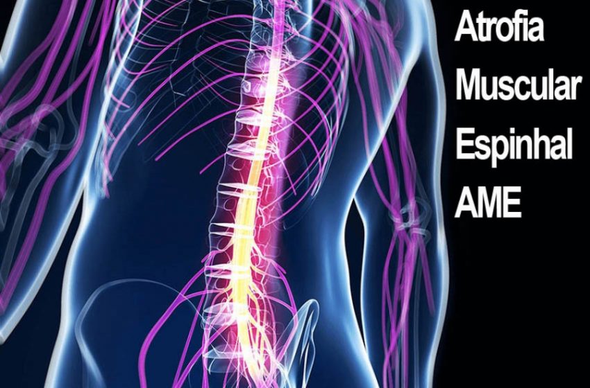 Medicamento para tratar atrofia espinhal muscular é incluído ao SUS