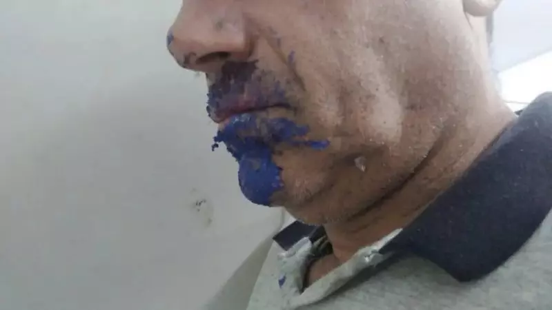  Homem é preso todo lambuzado e assume vício inusitado