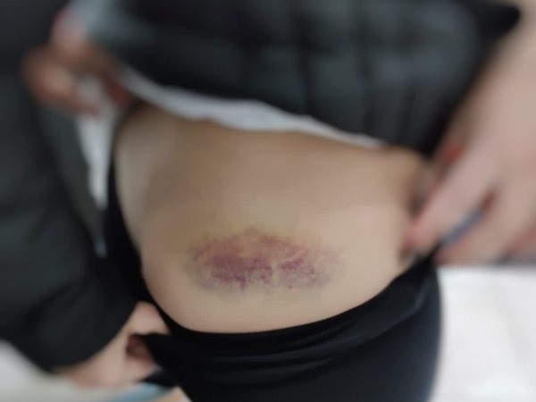  Mulher mantida como escrava sexual é resgatada em Itapema