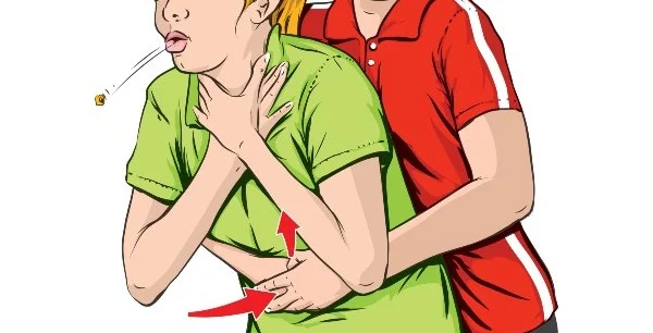  Filho executa manobra de heimlich e salva a mãe