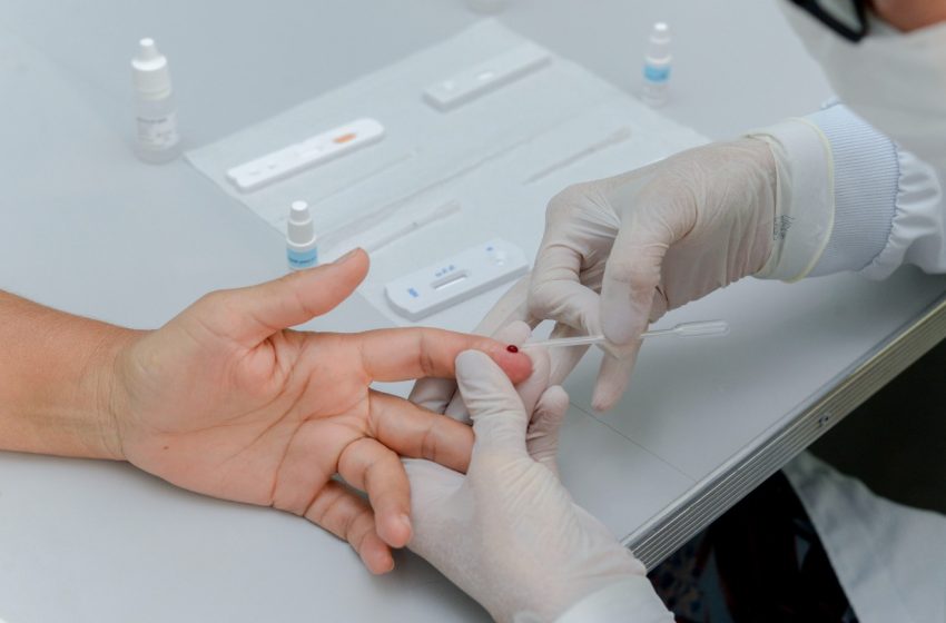 Testes rápidos de ISTs são oferecidos nas Unidades de Saúde