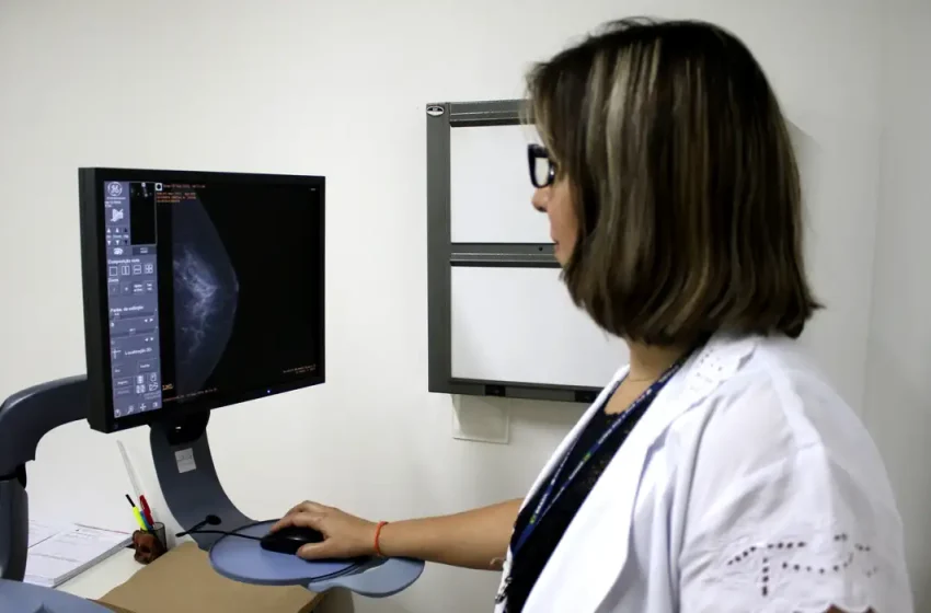  Mamografia no SUS a partir dos 40 anos